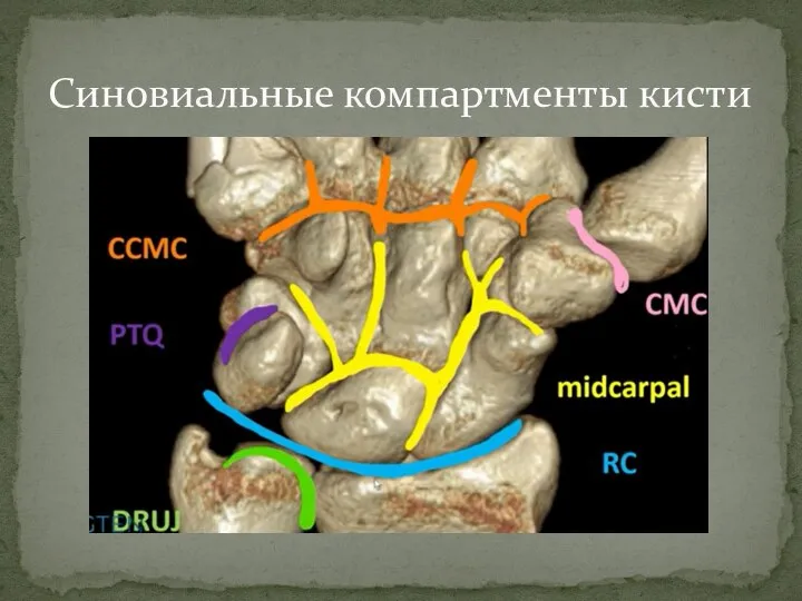 Синовиальные компартменты кисти