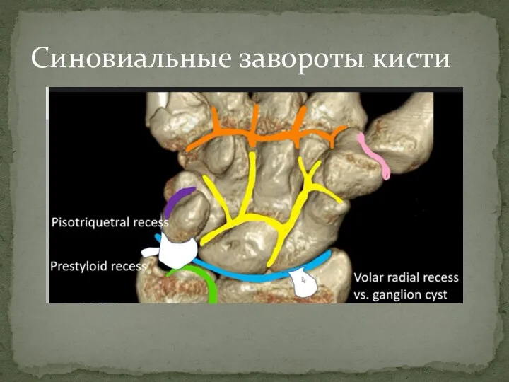 Синовиальные завороты кисти