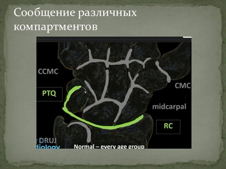 Сообщение различных компартментов