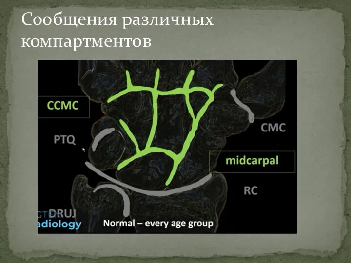 Сообщения различных компартментов