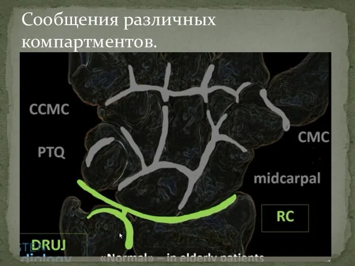 Сообщения различных компартментов.