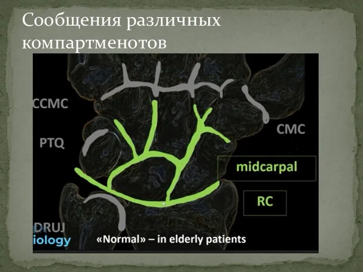 Сообщения различных компартменотов