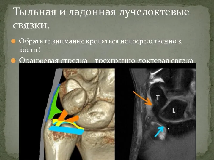 Обратите внимание крепяться непосредственно к кости! Оранжевая стрелка – трехгранно-локтевая связка Тыльная и ладонная лучелоктевые связки.