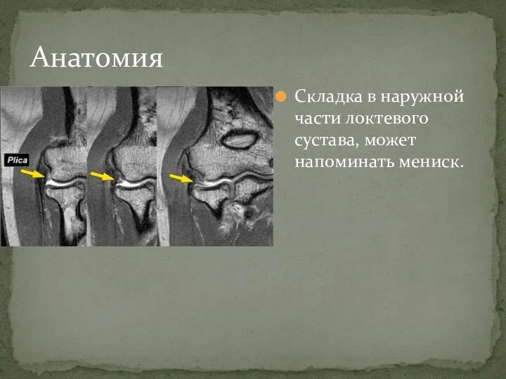 Складка в наружной части локтевого сустава, может напоминать мениск. Анатомия