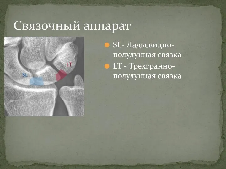 SL- Ладьевидно-полулунная связка LT - Трехгранно-полулунная связка Связочный аппарат