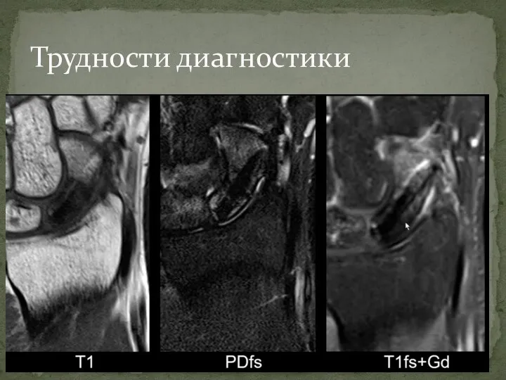 Трудности диагностики