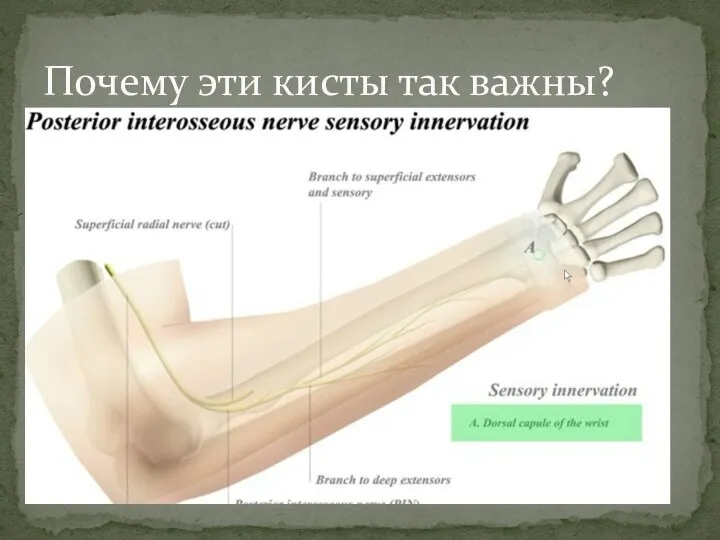 Почему эти кисты так важны?