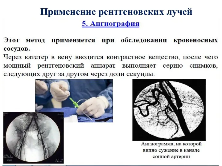 Применение рентгеновских лучей