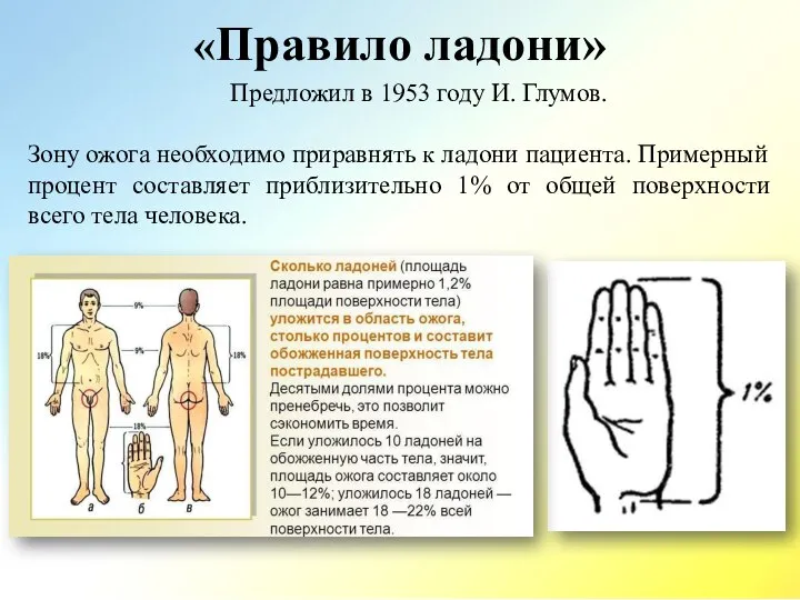 «Правило ладони» Предложил в 1953 году И. Глумов. Зону ожога необходимо приравнять