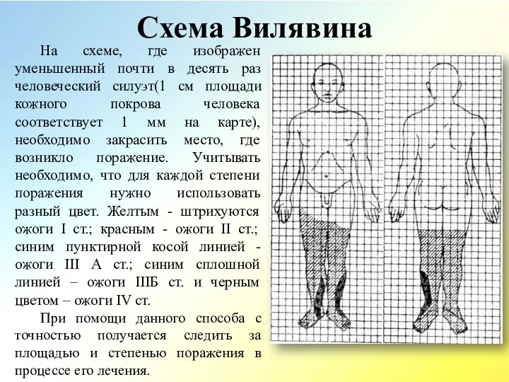 Схема Вилявина На схеме, где изображен уменьшенный почти в десять раз человеческий