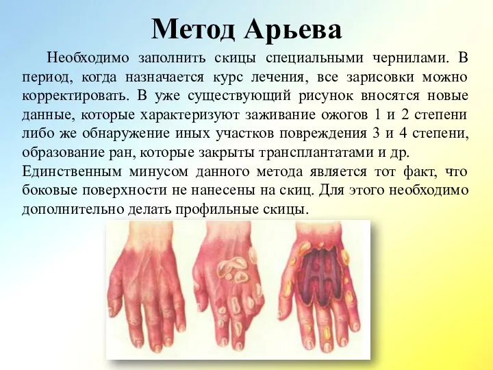 Метод Арьева Необходимо заполнить скицы специальными чернилами. В период, когда назначается курс