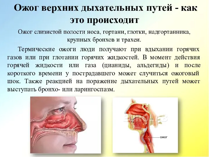 Ожог верхних дыхательных путей - как это происходит Термические ожоги люди получают