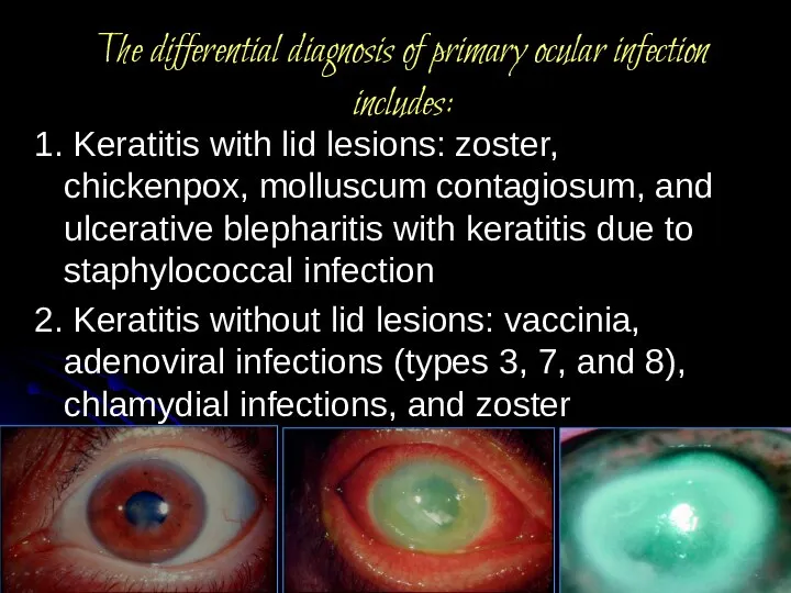 The differential diagnosis of primary ocular infection includes: 1. Keratitis with lid
