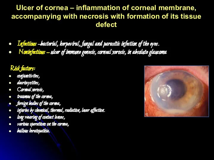Ulcer of cornea – inflammation of corneal membrane, accompanying with necrosis with