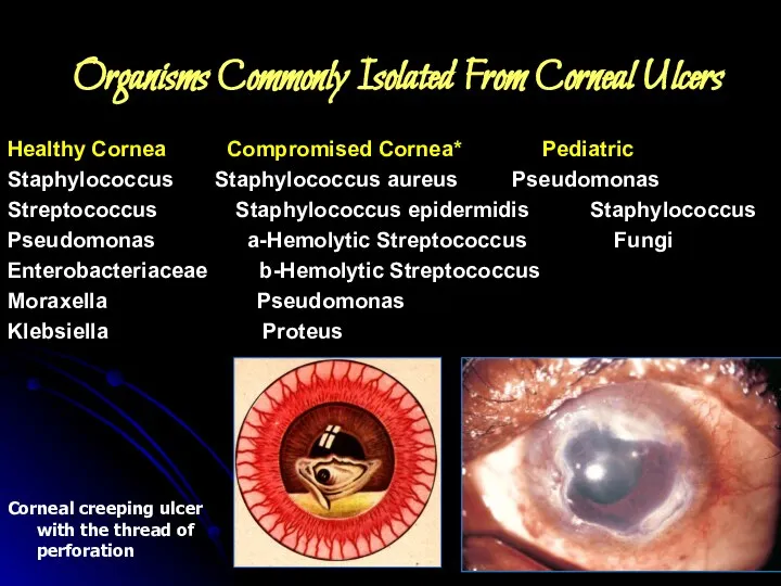 Organisms Commonly Isolated From Corneal Ulcers Healthy Cornea Compromised Cornea* Pediatric Staphylococcus