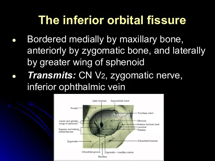 The inferior orbital fissure Bordered medially by maxillary bone, anteriorly by zygomatic