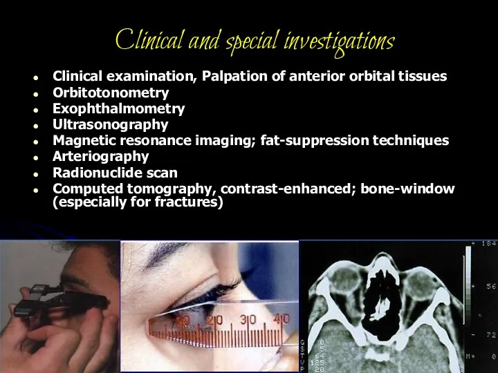 Clinical and special investigations Clinical examination, Palpation of anterior orbital tissues Orbitotonometry