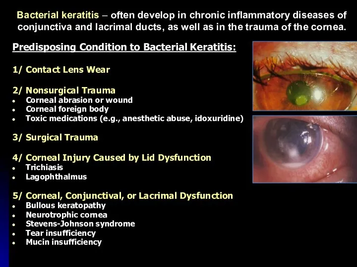 Bacterial keratitis – often develop in chronic inflammatory diseases of conjunctiva and
