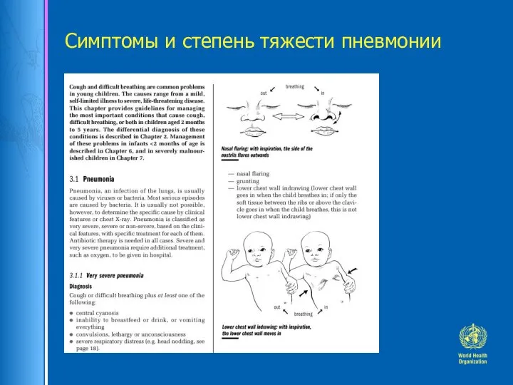 Симптомы и степень тяжести пневмонии