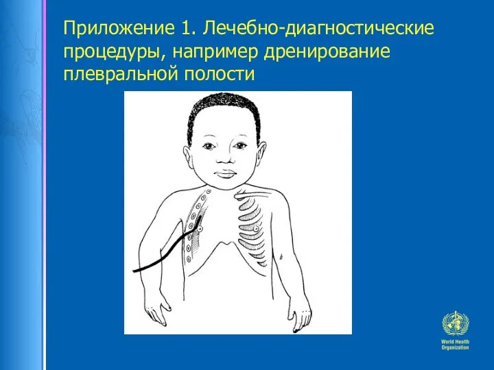 Приложение 1. Лечебно-диагностические процедуры, например дренирование плевральной полости