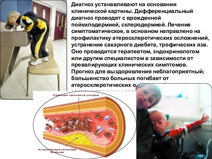 Диагноз устанавливают на основании клинической картины. Дифференциальный диагноз проводят с врожденной пойкилодермией,