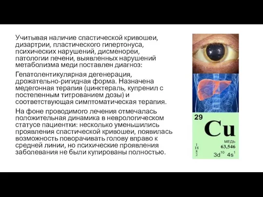 Учитывая наличие спастической кривошеи, дизартрии, пластического гипертонуса, психических нарушений, дисменореи, патологии печени,