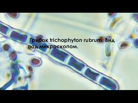 Грибок trichophyton rubrum. Вид под микроскопом.