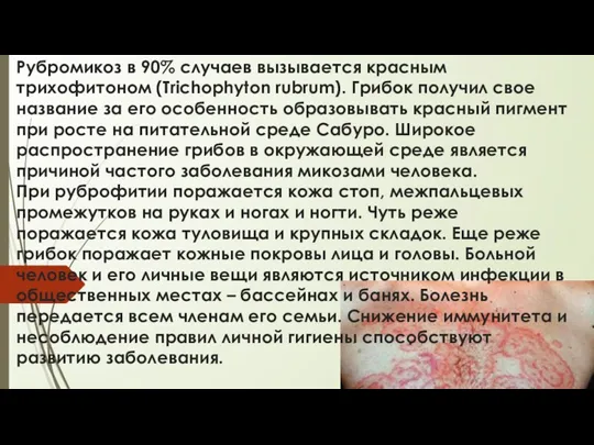 Рубромикоз в 90% случаев вызывается красным трихофитоном (Trichophyton rubrum). Грибок получил свое