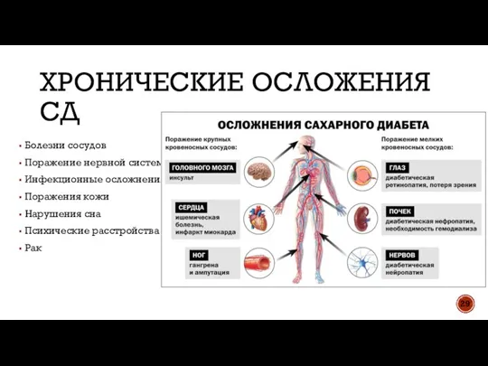 ХРОНИЧЕСКИЕ ОСЛОЖЕНИЯ СД Болезни сосудов Поражение нервной системы Инфекционные осложнения Поражения кожи