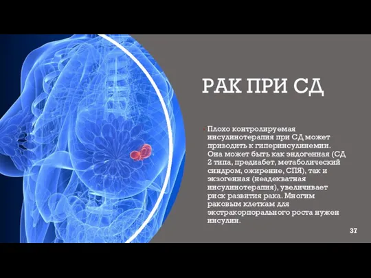 РАК ПРИ СД Плохо контролируемая инсулинотерапия при СД может приводить к гиперинсулинемии.