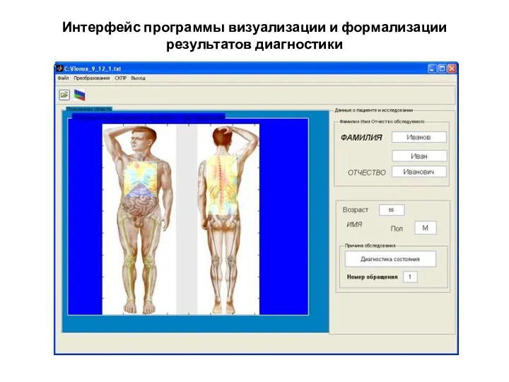 Интерфейс программы визуализации и формализации результатов диагностики