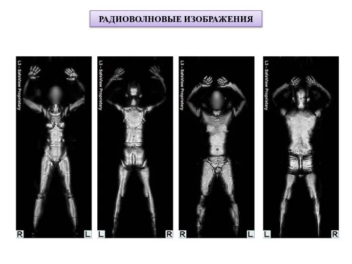 РАДИОВОЛНОВЫЕ ИЗОБРАЖЕНИЯ