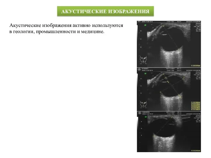 АКУСТИЧЕСКИЕ ИЗОБРАЖЕНИЯ Акустические изображения активно используются в геологии, промышленности и медицине.