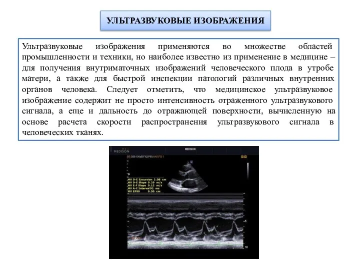 УЛЬТРАЗВУКОВЫЕ ИЗОБРАЖЕНИЯ Ультразвуковые изображения применяются во множестве областей промышленности и техники, но