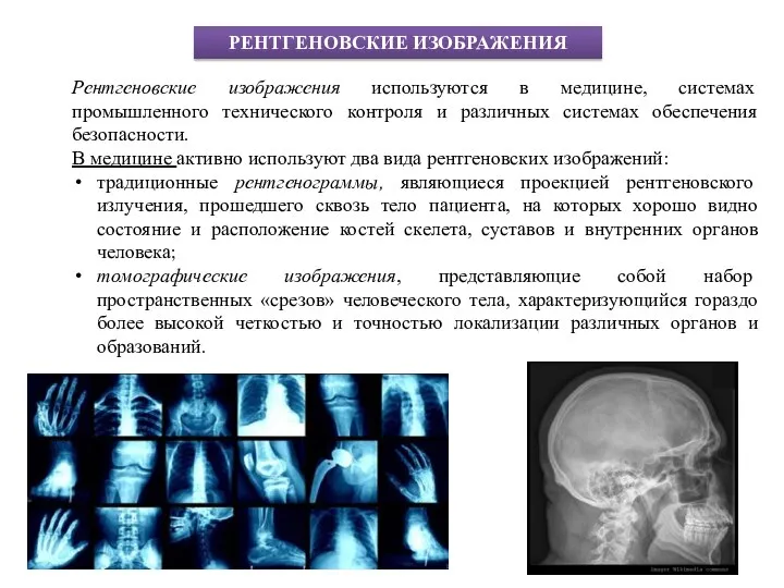 РЕНТГЕНОВСКИЕ ИЗОБРАЖЕНИЯ Рентгеновские изображения используются в медицине, системах промышленного технического контроля и