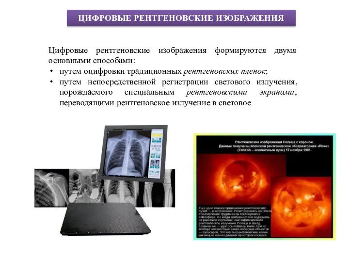 ЦИФРОВЫЕ РЕНТГЕНОВСКИЕ ИЗОБРАЖЕНИЯ Цифровые рентгеновские изображения формируются двумя основными способами: путем оцифровки