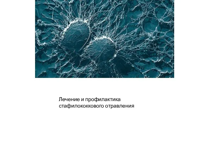 Лечение и профилактика стафилококкового отравления