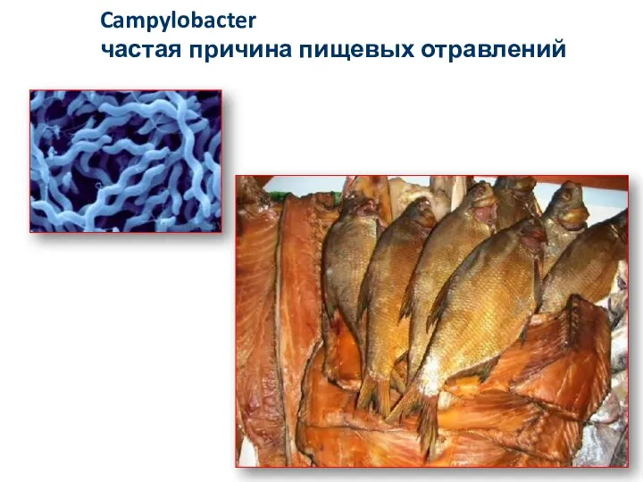 Campylobacter частая причина пищевых отравлений