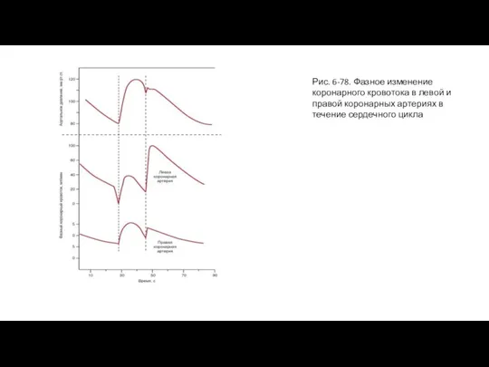 Рис. 6-78. Фазное изменение коронарного кровотока в левой и правой коронарных артериях в течение сердечного цикла