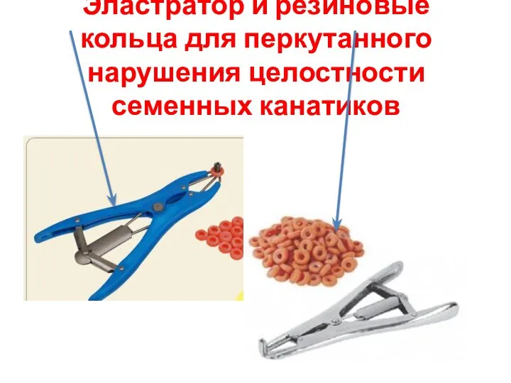 Эластратор и резиновые кольца для перкутанного нарушения целостности семенных канатиков