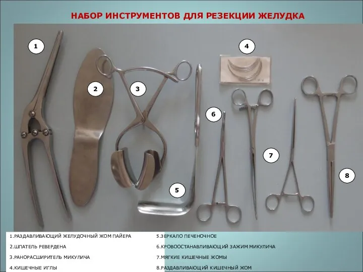 НАБОР ИНСТРУМЕНТОВ ДЛЯ РЕЗЕКЦИИ ЖЕЛУДКА 1.РАЗДАВЛИВАЮЩИЙ ЖЕЛУДОЧНЫЙ ЖОМ ПАЙЕРА 2.ШПАТЕЛЬ РЕВЕРДЕНА 3.РАНОРАСШИРИТЕЛЬ