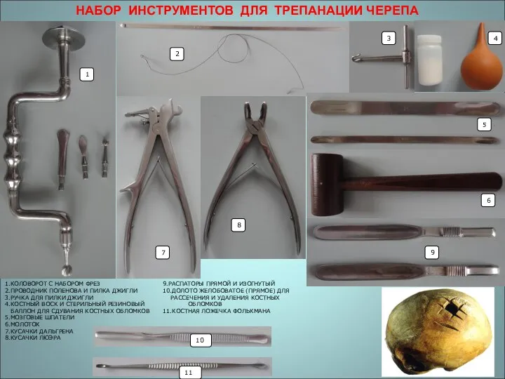 1.КОЛОВОРОТ С НАБОРОМ ФРЕЗ 2.ПРОВОДНИК ПОЛЕНОВА И ПИЛКА ДЖИГЛИ 3.РУЧКА ДЛЯ ПИЛКИ