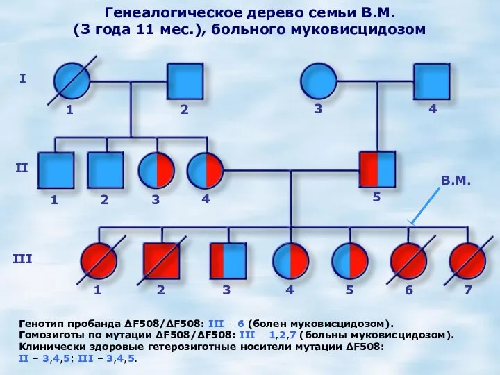 Генеалогическое дерево семьи В.М. (3 года 11 мес.), больного муковисцидозом I II