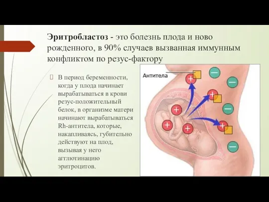 Эритробластоз - это болезнь плода и ново­рожденного, в 90% случаев вызванная иммунным