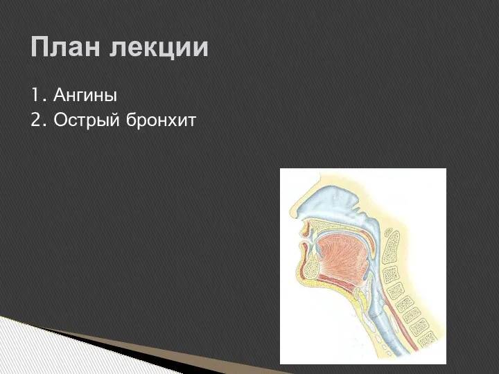 1. Ангины 2. Острый бронхит План лекции