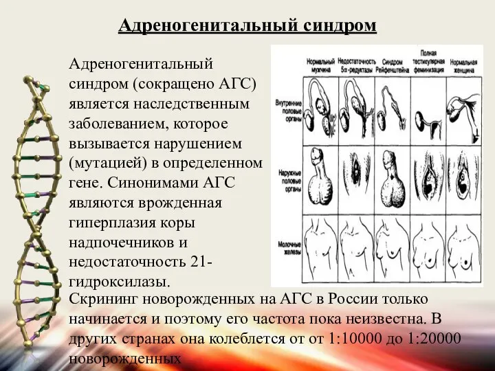 Адреногенитальный синдром (сокращено АГС) является наследственным заболеванием, которое вызывается нарушением (мутацией) в