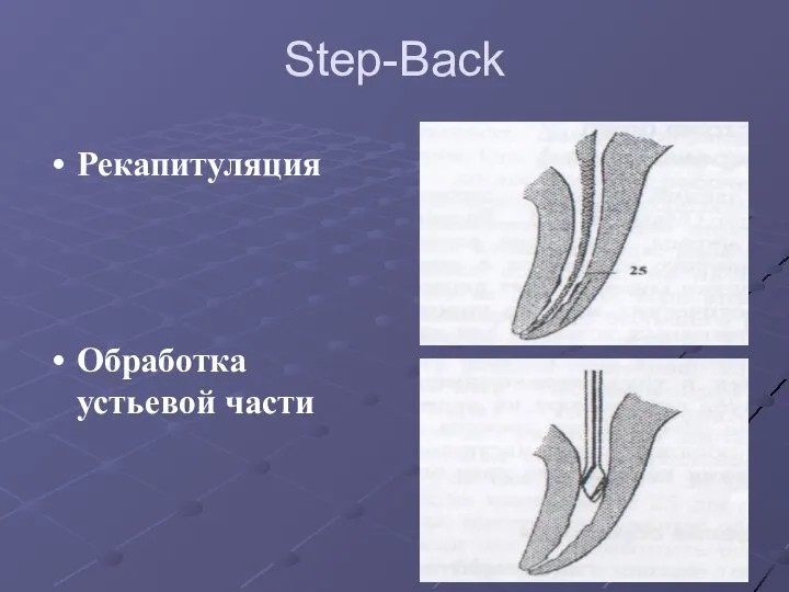 Step-Back Рекапитуляция Обработка устьевой части