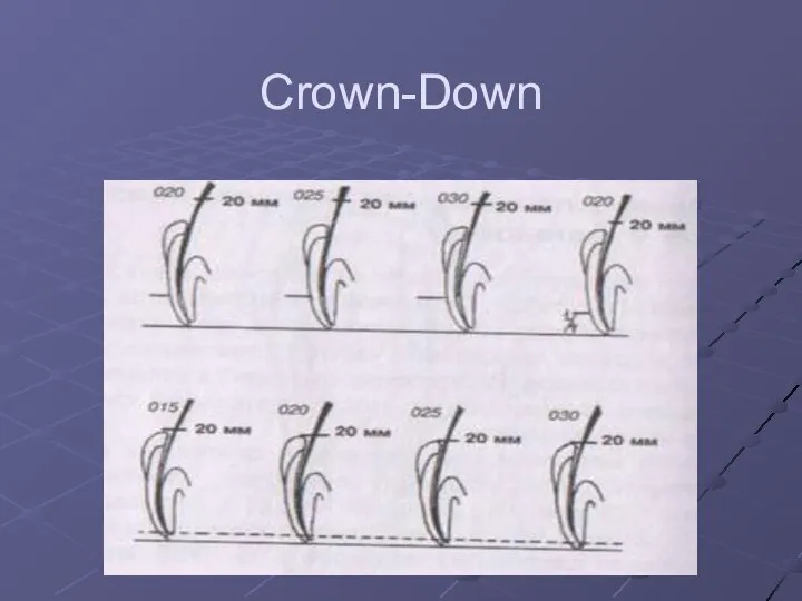 Crown-Down