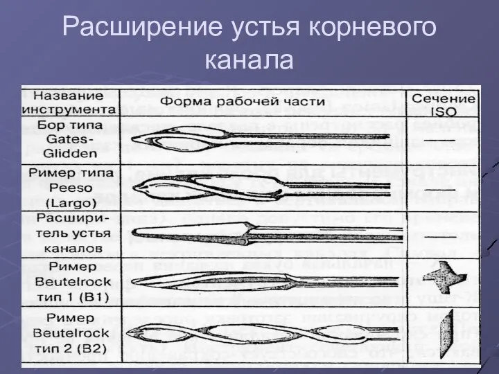 Расширение устья корневого канала