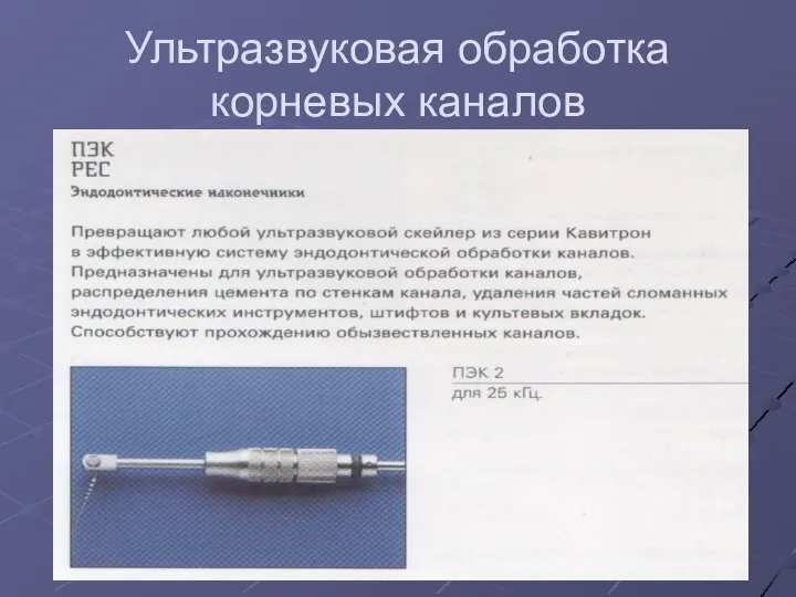 Ультразвуковая обработка корневых каналов